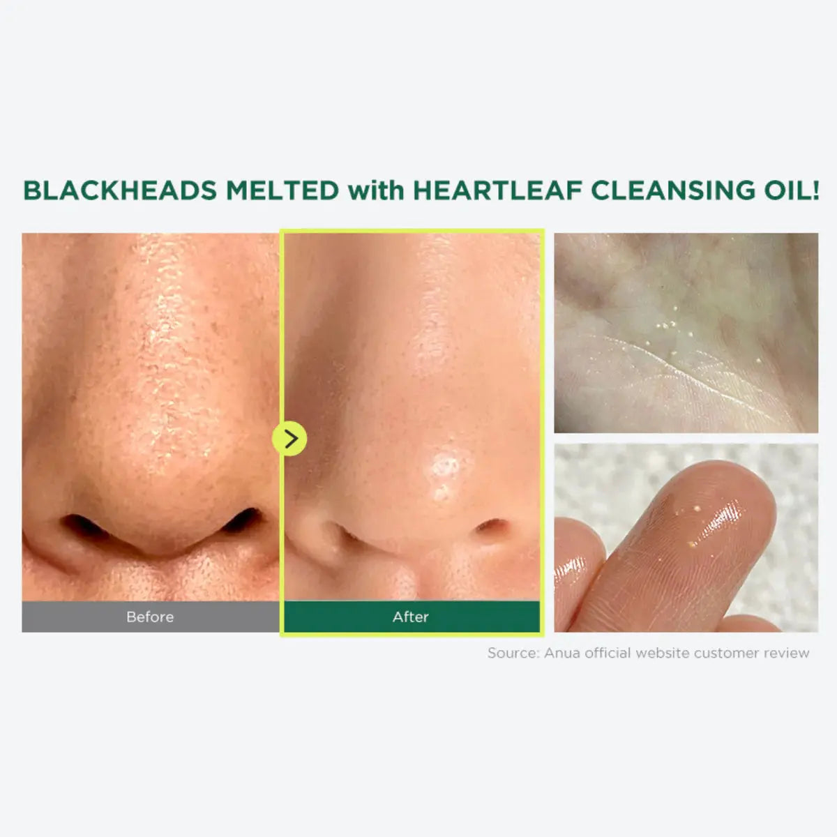Anua - Heartleaf Pore Cleansing Oil (200 ml) Ma boutique